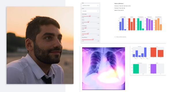 Wissam Siblini uses Streamlit for pathology detection in chest radiographs